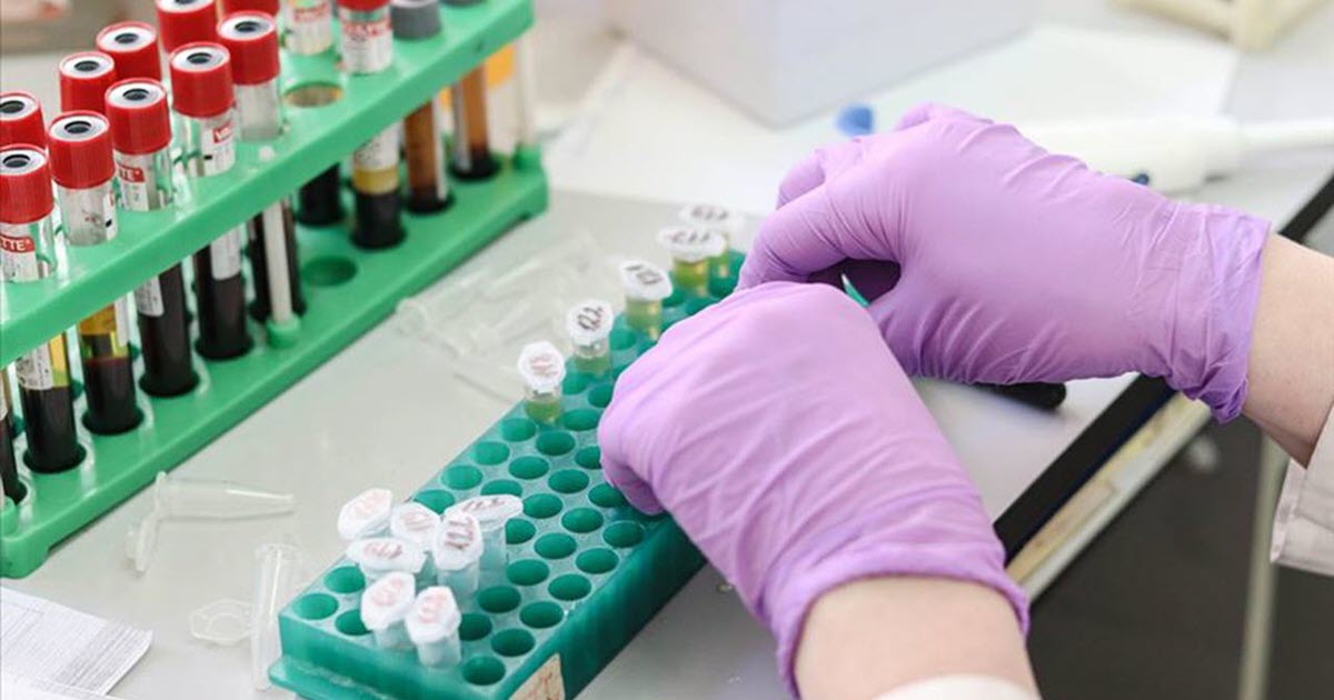 EVLENECEK ÇİFTLERE SMA TARAMASI AİLE HEKİMLİKLERİNDE BAŞLIYOR