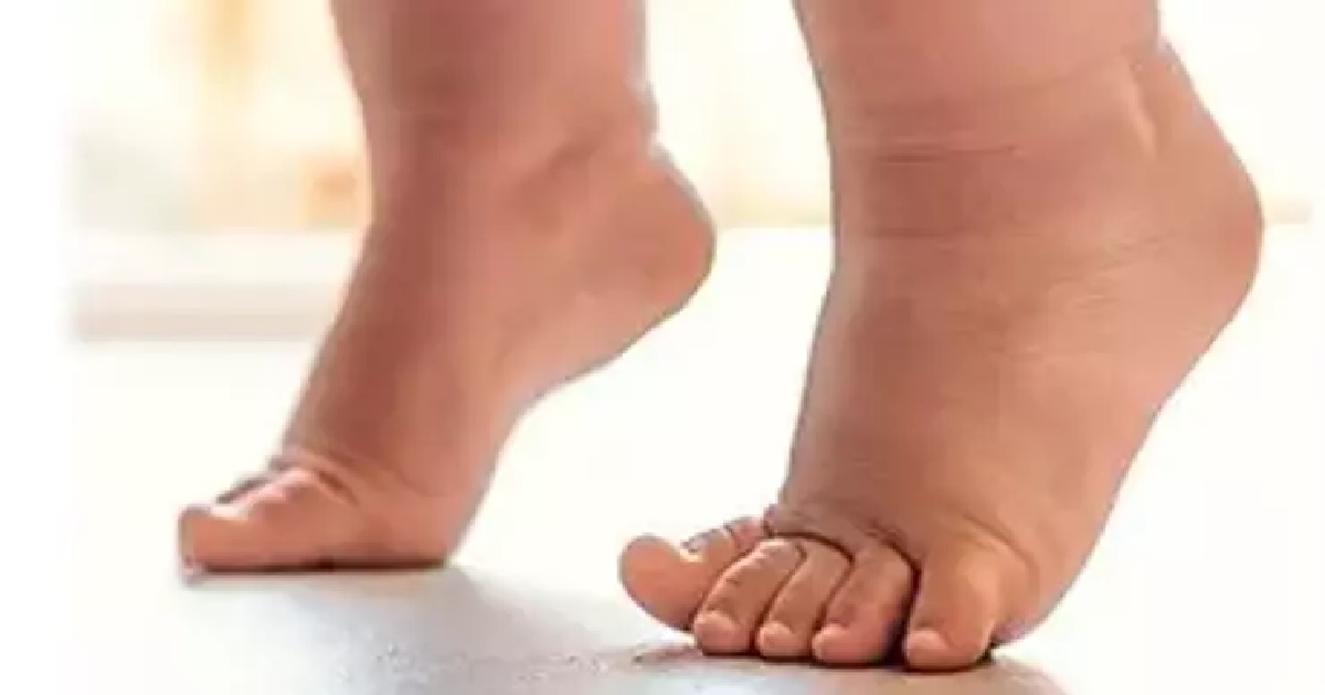 ÇOCUKLARDA BU YÜRÜYÜŞ ŞEKLİNE DİKKAT